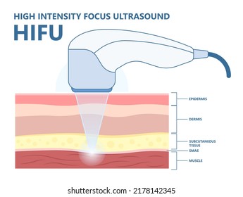 HIFU High Intensity Focus Ultrasound face saggy skin treat cell body lift laser hair firm tightening brow toxin droopy double chin scar