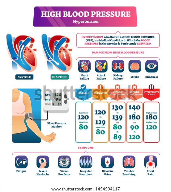 Explicación de la prueba de presión arterial