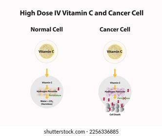 High Dosage Vitamin C Lead to Cancer Cell Dealth