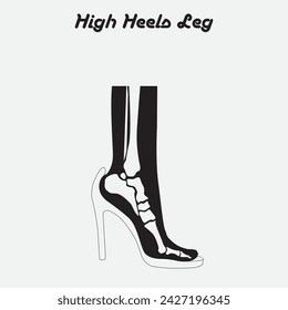 high heeled, Foot bones of woman wearing high heels,x-ray, isolated on white, Deformation of the foot bones in high heeled, vector illustration