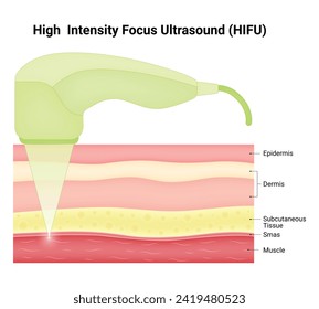 Ilustración de vectores de diseño de ciencia de ultrasonido de alta intensidad