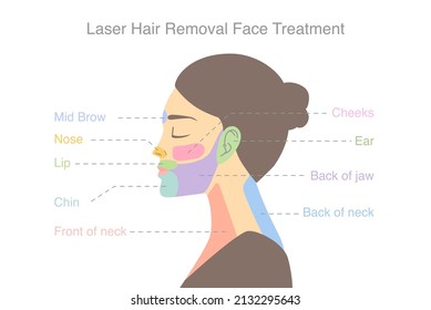 Highlight on woman's face area to do laser hair removal treatments. Illustration about diagram for a beauty treatment with laser.