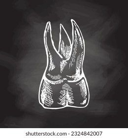 Highly detailed hand drawn human tooth  with roots. Hand drawn sketch. Molar illustration isolated on chalkboard background.