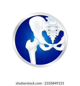 Hip bone, pelvis and joint in circle label aluminum. Cartilage healthy. Foods logo products template design. Medical food supplement concepts. Vector EPS10.