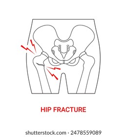 Diseño médico de la fractura de cadera con ilustración de estilo de línea