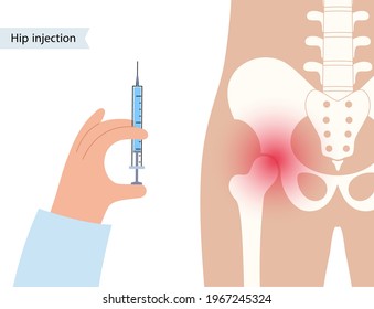 Hip joint cortisone injection. Pain and inflammation in the pelvis. Pelvic arthritis disease concept. Medical research in health care center. Bursitis treatment flat vector illustration for clinic.