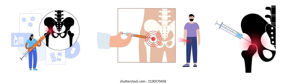 Inyección de cortisona en las articulaciones de la cadera. Dolor e inflamación en la pelvis. Concepto de artritis pélvica. Investigación médica en centros de salud. Bursitis tratamiento de ilustración vectorial plana para clínica.