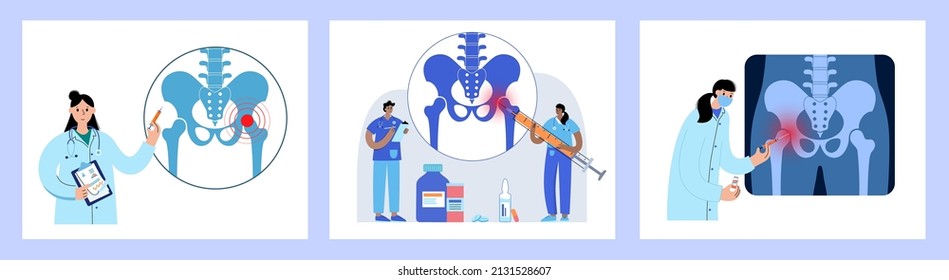Hip joint cortisone injection. Pain and inflammation in the pelvis. Pelvic arthritis disease concept. Medical research in health care center. Bursitis treatment flat vector illustration for clinic.