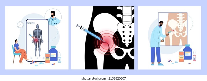 Hip joint cortisone injection. Pain and inflammation in the pelvis. Pelvic arthritis disease concept. Medical research in health care center. Bursitis treatment flat vector illustration for clinic.