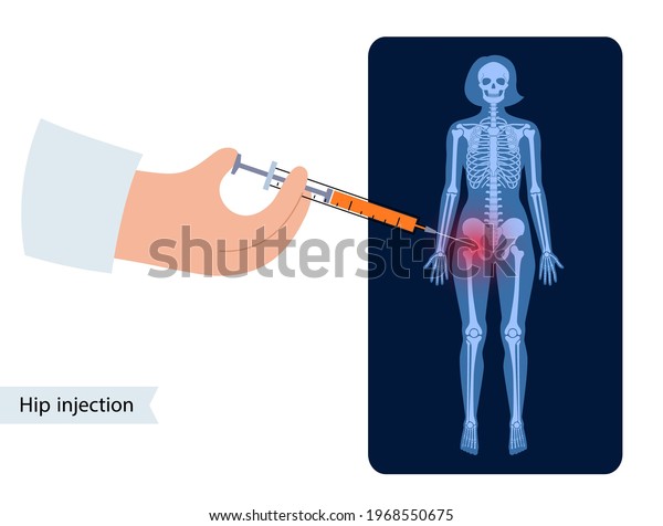 Hip Bursitis Injection