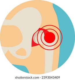 Hip joint structure. Arthritis of the hip joint. Hip Osteoarthritis Icon.  Pain, fracture or inflammation in pelvis. Front view. Flat vector illustration. 