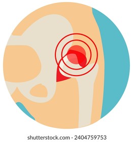 Hip Osteoarthritis icon. Flat style. Front view of hip joint with section of the pelvis. Lower back and joint pain. Medical, healthcare, elderly diseases graphic concept