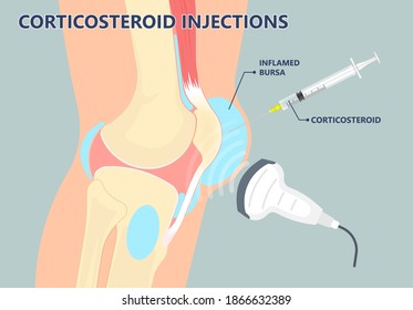 Hip pain knee heel cuff bone gout drug Feet bursa joint elbow treat tear drain shots fluid Ankle bursae tendon muscle trauma injury septic frozen tennis therapy rotator disease greater relieve swollen