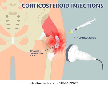 Hip pain knee heel cuff bone gout drug Feet bursa joint elbow treat tear drain shots fluid Ankle bursae tendon muscle trauma injury septic frozen tennis therapy rotator disease greater relieve swollen