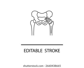 Ilustración de reemplazo de cadera que muestra el implante articular para diseños médicos y visuales ortopédicos, perfecto para materiales de atención médica y estudios de anatomía.