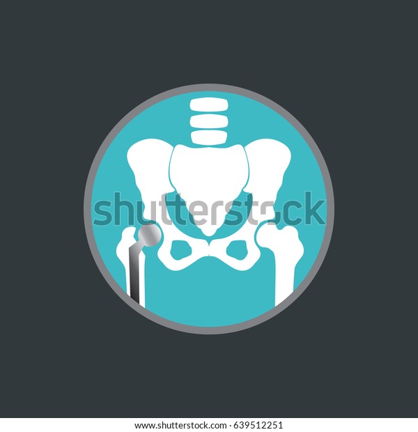 Hip Replacement Logo Vector Icon Design Stock Vector (Royalty Free ...