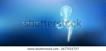 Hip replacement. Prosthetic implant integrated into the femur bone. Orthopedic technology artificial joint surgery in a transparent anatomical. Medical health care vector.
