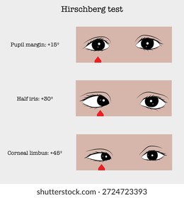 Prueba de Hirschberg: posición de los reflejos de la luz corneal, medición de la desviación visual.