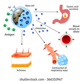 Histamine. Local Immune Responses. Allergic Reaction