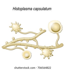 Histoplasma capsulatum is a fungus cause disease of lungs.