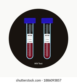 HIV blood testing in tubes with positive an negative labels vector illustration. Healthcare and medical concept