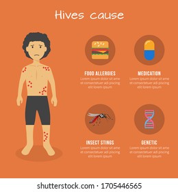 Hives cause infographic template. Healthcare and medical infographic