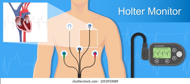 Holter monitoring system tracking cardio problem failure sick irregular disorders transducer therapy cardioversion heartbeat non invasive diagnosis treat