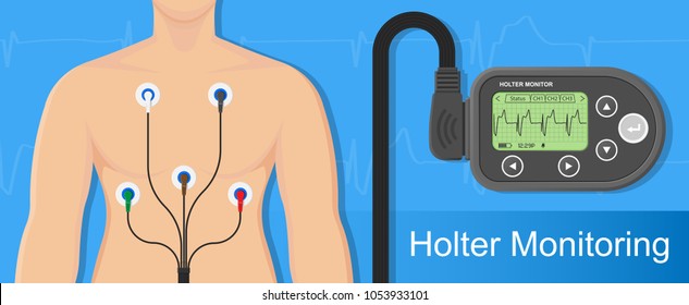 Holter monitoring system tracking cardio problem failure sick irregular disorders transducer therapy cardioversion heartbeat non invasive diagnosis treat