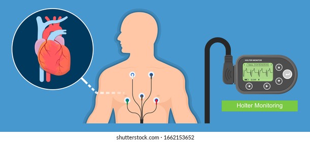 Holter monitoring system tracking cardio problem failure sick irregular disorders transducer therapy cardioversion heartbeat non invasive diagnosis treat