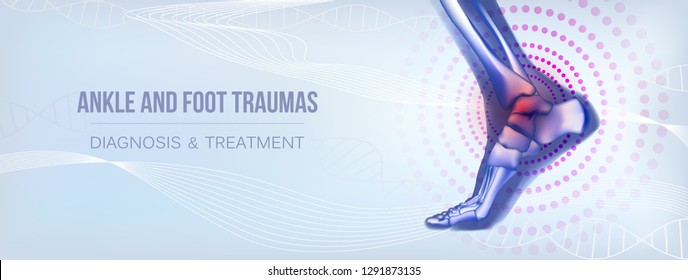 Horizontal light blue banner with ankle and foot joints traumas concept. For advertising, medical publications in social media. Realistic bones of foot skeleton of human leg. Vector illustration stock