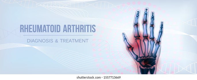 Horizontal rheumatoid arthritis hand sore joints concept for social media
