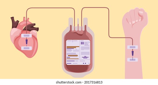 886 Platelet transfusion Images, Stock Photos & Vectors | Shutterstock