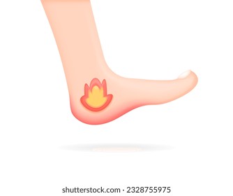 hot sensation on the heel of the foot. heel aches, pains, and hot. The feet feel hot as burn sensation. health problems. Minimalist 3D illustration design. vector elements. white background