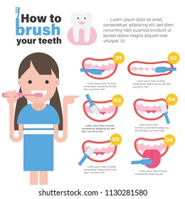 Kindergarten Steps To Brush Your Teeth - Teeth Poster