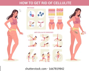 How To Get Ride Of Cellulite Instruction. Beauty Tips For Smooth Skin. Beautiful Woman With Massage Brush And Anti-cellulite Cream. Dry Brushing, Diet And Exercises. Isolated Vector Illustration