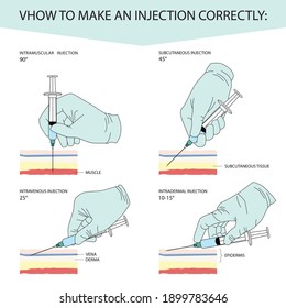 Different Types Of Injections - Goimages Today