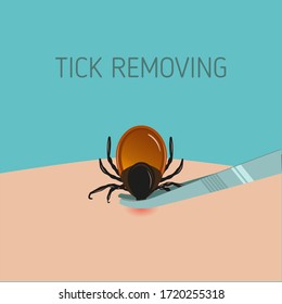 How to remove mite insect parasitic. Encephalitis Tick Warning Sign.