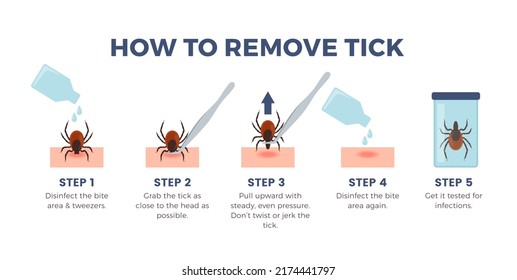 How to remove tick infographics banner, flat vector illustration on white background. Mite removal steps - disinfection, pulling upward with tweezers, laboratory testing. Dangerous parasite bite.