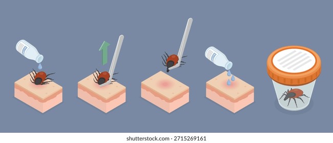 Cómo eliminar tick steps Infographic Anuncio. Instrucción para prevenir la enfermedad de Lyme o borreliosis debido a la picadura de ácaros. Ilustración vectorial isométrica plana 3D sobre un fondo gris.