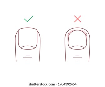 How to trim your toenails correctly. Proper and improper trimming of nails. Line illustration of cut straight and cut too deep. Pedicure, manicure, beauty spa salon