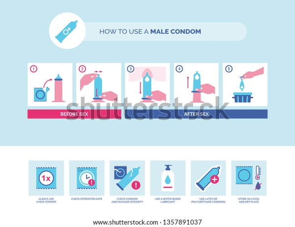 男性コンドームの使い方とヒント 避妊性感染症予防 のベクター画像素材 ロイヤリティフリー