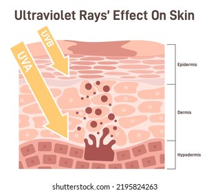 How UV rays effect on skin. UVA, UVB rays go through the skin cells to hypodermis producing melanin. Flat vector illustration