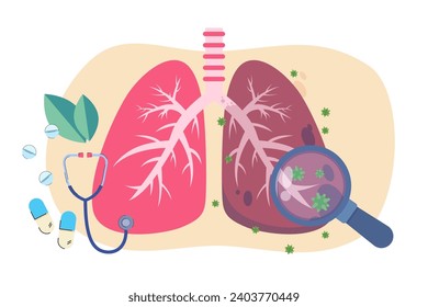 Huge human lungs affected with disease. Vector illustration. Pills, stethoscope, magnifying glass, virus. Treatment of tuberculosis, cure for lung diseases concept