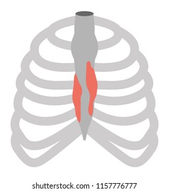 
Huma ribs cage having infection inside costochondritis concept 
