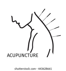 Human acupuncture with needles. Medical procedure illustration. Chinese Traditional, Alternative Medicine, Natural Healing and Recreation concept. Vector