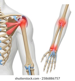 Human anatomy and arthritis model