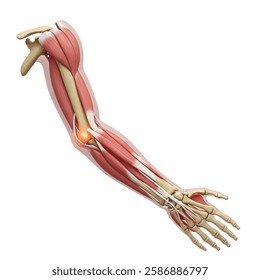 Human anatomy and arthritis model