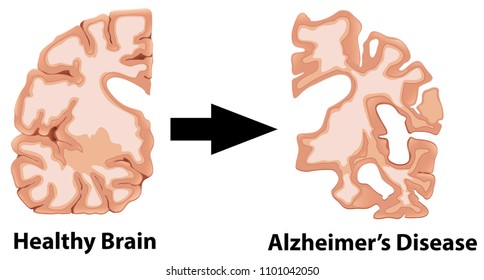 Una anatomía humana de la ilustración del cerebro