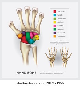 Metacarpal Images, Stock Photos & Vectors | Shutterstock