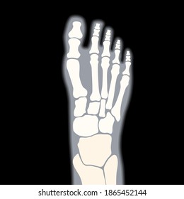 Human ankle icon for clinic. Normal foot joints and bones anatomy in leg silhouette. Skeleton x ray medical poster. Orthopedic or chiropractic treatment. Anatomical logo concept. vector illustration.